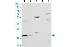 Western blot analysis of Lane 1: RT-4, Lane 2: U-251 MG, Lane 3: Human Plasma, Lane 4: Liver, Lane 5: Tonsil with RMI2 polyclonal antibody  at 1:250-1:500 dilution. (RMI2 anticorps)