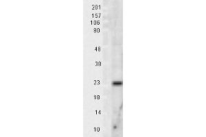 Mn SOD Rat tissue lysate 10ug Western Blotting 1 in 1000 copy. (SOD2 anticorps)
