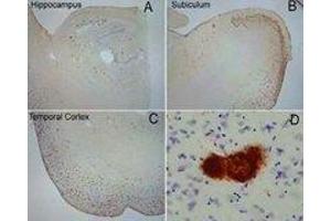 Labeling of amyloid fibrils was observed in the hippocampus (A), subiculum (B) and frontal cortex (C) in Alzheimer disease. (Amyloid Fibrils anticorps)