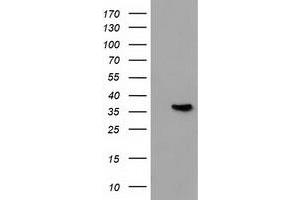Western Blotting (WB) image for anti-Annexin A3 (ANXA3) antibody (ABIN1496646) (Annexin A3 anticorps)