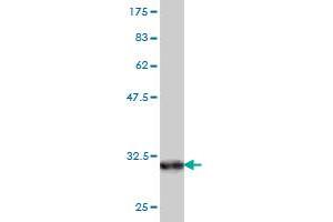 Western Blot detection against Immunogen (31.