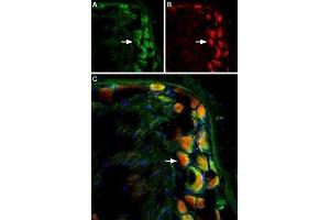 Multiplex staining of TRPV2 and mGluR5 in rat DRG - Immunohistochemistry of rat dorsal root ganglion using Guinea pig Anti-TRPV2 (VRL1) (extracellular) Antibody (ABIN7043843, ABIN7045390 and ABIN7045391) (1:60) and Anti-mGluR5 (extracellular)-ATTO Fluor-594 Antibody (ABIN7043251), (red), (1:60).
