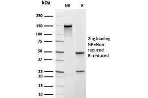 SDS-PAGE Analysis Purified Frataxin Recombinant Mouse Monoclonal Antibody (rFXN/2124). (Recombinant Frataxin anticorps  (AA 57-210))