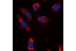 Immunofluorescent analysis of STMN1 staining in HeLa cells. (Stathmin 1 anticorps  (N-Term))