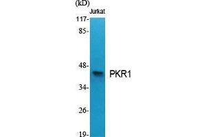 Western Blot (WB) analysis of specific cells using PKR1 Polyclonal Antibody.