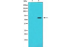 Western blot analysis of Angiopoietin 1 expression in HeLa cells,The lane on the left is treated with the antigen-specific peptide. (Angiopoietin 1 anticorps  (Internal Region))