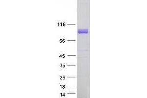 Validation with Western Blot