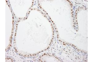 Immunohistochemistry (IHC) image for anti-FK506 Binding Protein 5 (FKBP5) (AA 407-457) antibody (ABIN7454751)