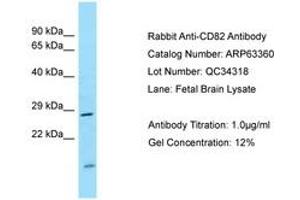 Image no. 1 for anti-CD82 (CD82) (AA 98-147) antibody (ABIN6749974) (CD82 anticorps  (AA 98-147))