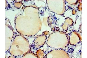 Immunohistochemistry of paraffin-embedded human thyroid tissue using ABIN7156617 at dilution of 1:100