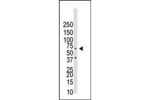 Western blot analysis of anti-BR1B Pab ap2005a in NCI- cell lysate.