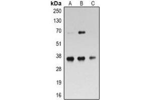 Western blot analysis of RPL5 expression in Hela (A), Jurkat (B), MOLT4 (C) whole cell lysates. (RPL5 anticorps)