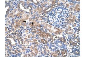 GALNT6 antibody was used for immunohistochemistry at a concentration of 4-8 ug/ml to stain Epithelial cells of renal tubule (arrows) in Human Kidney.