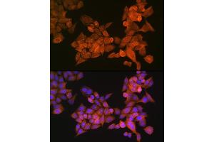Immunofluorescence analysis of HeLa cells using PALLD Rabbit pAb  at dilution of 1:100 (40x lens).