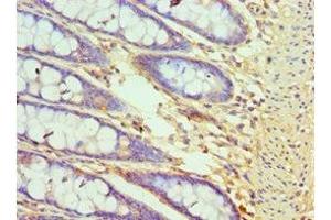 Immunohistochemistry of paraffin-embedded human colon tissue using ABIN7148781 at dilution of 1:100 (CXXC1 anticorps  (AA 1-210))