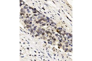 IHC analysis of FOXF1 using anti-FOXF1 antibody (ABIN7601744). (FOXF1 anticorps  (AA 44-379))