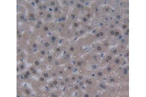 IHC-P analysis of liver tissue, with DAB staining. (DKC1 anticorps  (AA 298-509))