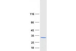 Validation with Western Blot