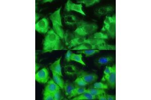 Immunofluorescence analysis of U-2 OS cells using Ezrinin antibody (ABIN6129377, ABIN6140400, ABIN6140401 and ABIN6213959) at dilution of 1:100.