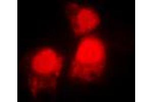 Immunofluorescent analysis of SIAH2 staining in MCF7 cells.
