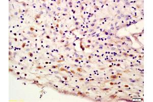 Formalin-fixed and paraffin embedded human placenta labeled with Anti-lamin A/C Polyclonal Antibody, Unconjugated (ABIN735188) at 1:200 followed by conjugation to the secondary antibody and DAB staining (Lamin A/C anticorps  (AA 1-100))