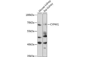 Western blot analysis of extracts of Mouse kidney, using CYP4X1 antibody (ABIN7266659) at 1:1000 dilution. (CYP4X1 anticorps  (AA 190-290))