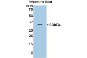 Detection of Recombinant CYP24A1, Mouse using Polyclonal Antibody to Cytochrome P450 24A1 (CYP24A1) (CYP24A1 anticorps  (AA 260-514))