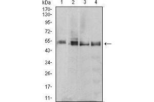 Western blot analysis using *** mouse mAb against MCF-7 (1), T47D (2), MOLT4 (3), and Raji (4) cell lysate. (MTRF1 anticorps  (AA 288-437))