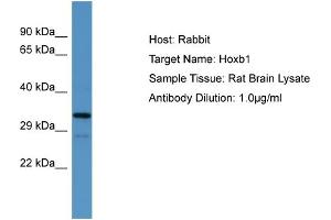 Host:  Rabbit  Target Name:  Hoxb1  Sample Type:  Rat Brain lysates  Antibody Dilution:  1.