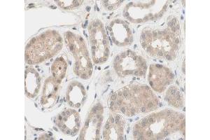 ABIN6266539 at 1/100 staining human kidney tissue sections by IHC-P. (FGFR2 anticorps  (C-Term))