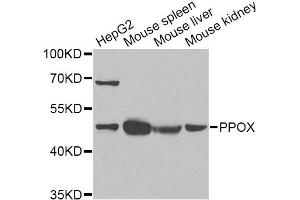Western blot analysis of extracts of various cell lines, using PPOX Antibody (ABIN2564653) at 1:1000 dilution. (PPOX anticorps)