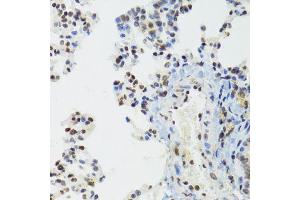 Immunohistochemistry of paraffin-embedded mouse lung using BAZ1B antibody (ABIN6003583) at dilution of 1/100 (40x lens). (BAZ1B anticorps)