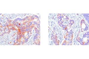 Immunohistochemistry (IHC) image for anti-Heat Shock 27kDa Protein 1 (HSPB1) (AA 1-205), (N-Term) antibody (ABIN317528) (HSP27 anticorps  (N-Term))