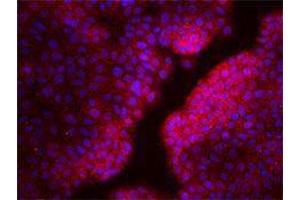 Immunofluorescence (IF) image for anti-Chemokine (C-X-C Motif) Receptor 4 (CXCR4) antibody (ABIN2664315) (CXCR4 anticorps)