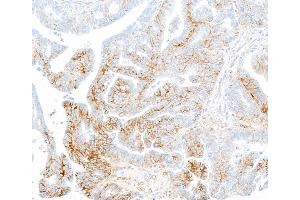 Immunohistochemistry (IHC) image for anti-Syndecan 1 (SDC1) (AA 23-251) antibody (ABIN7795739)