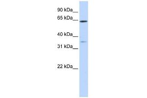 TRIM45 antibody used at 1 ug/ml to detect target protein. (TRIM45 anticorps  (Middle Region))
