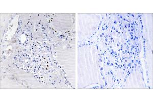 Peptide - +Immunohistochemistry analysis of paraffin-embedded human thyroid gland tissue using C9orf89 antibody.
