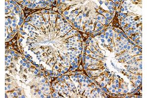 ABIN6254898 and ABIN6279150 at 1/100 staining Mouse testis tissue by IHC-P. (ATXN7L1 anticorps  (N-Term))