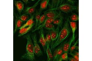 IF analysis of SCML1 using anti-SCML1 antibody (ABIN7602479) and anti-Tubulin Alpha antibody (ABIN7600339). (SCML1 anticorps  (AA 8-322))