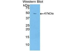 Western Blotting (WB) image for anti-Lymphotoxin beta Receptor (TNFR Superfamily, Member 3) (LTBR) (AA 128-395) antibody (ABIN1859718) (LTBR anticorps  (AA 128-395))