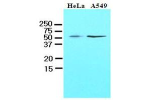 Western Blotting (WB) image for anti-Kruppel-Like Factor 4 (Gut) (KLF4) (AA 1-170), (N-Term) antibody (ABIN336104) (KLF4 anticorps  (N-Term))