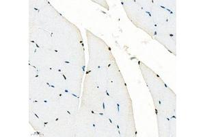 Immunohistochemistry of paraffin embedded rat skeletal muscle using SIX1 (ABIN7075617) at dilution of 1: 650 (400x lens) (SIX Homeobox 1 anticorps)