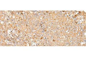 anti-Peroxiredoxin 4 (PRDX4) antibody