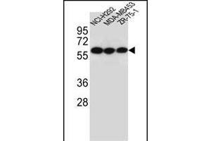 CHRNA10 Antibody (Center) (ABIN656120 and ABIN2845459) western blot analysis in NCI-,MDA-M,ZR-75-1 cell line lysates (35 μg/lane). (CHRNA10 anticorps  (AA 179-206))