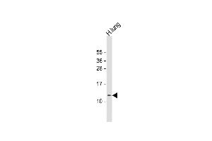 Anti-RIG Antibody (C-Term) at 1:1000 dilution + human lung lysate Lysates/proteins at 20 μg per lane.