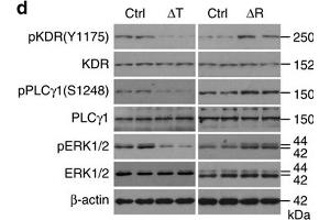 Regulation of VEGF in osteoblasts by mTORC1 does not explain the vascular phenotypes of mutant mouse bone.