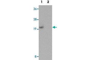 Western blot analysis of human kidney tissue with PIAS1 polyclonal antibody  at 1 ug/mL in (Lane 1) the absence and (Lane 2) the presence of blocking peptide. (PIAS1 anticorps  (C-Term))
