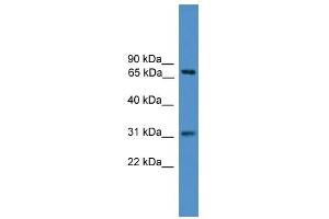 WB Suggested Anti-ZNF471 Antibody Titration:  0.