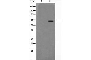 Western blot analysis on 293 cell lysate using PIAS3 Antibody,The lane on the left is treated with the antigen-specific peptide.