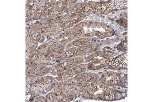 Immunohistochemical staining of human stomach with LRCH4 polyclonal antibody  shows moderate cytoplasmic and membranous positivity in glandular cells. (LRCH4 anticorps)